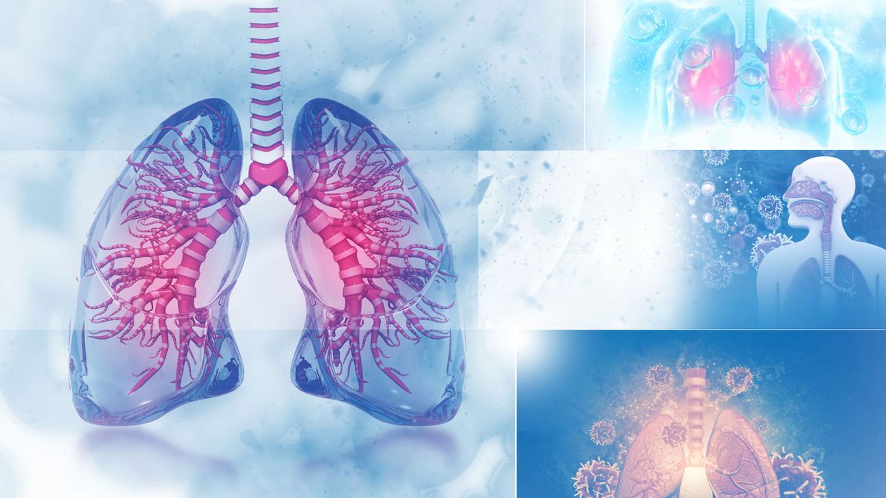 Neues rund um die COPD - Pneumologie - Universimed - Medizin im Fokus