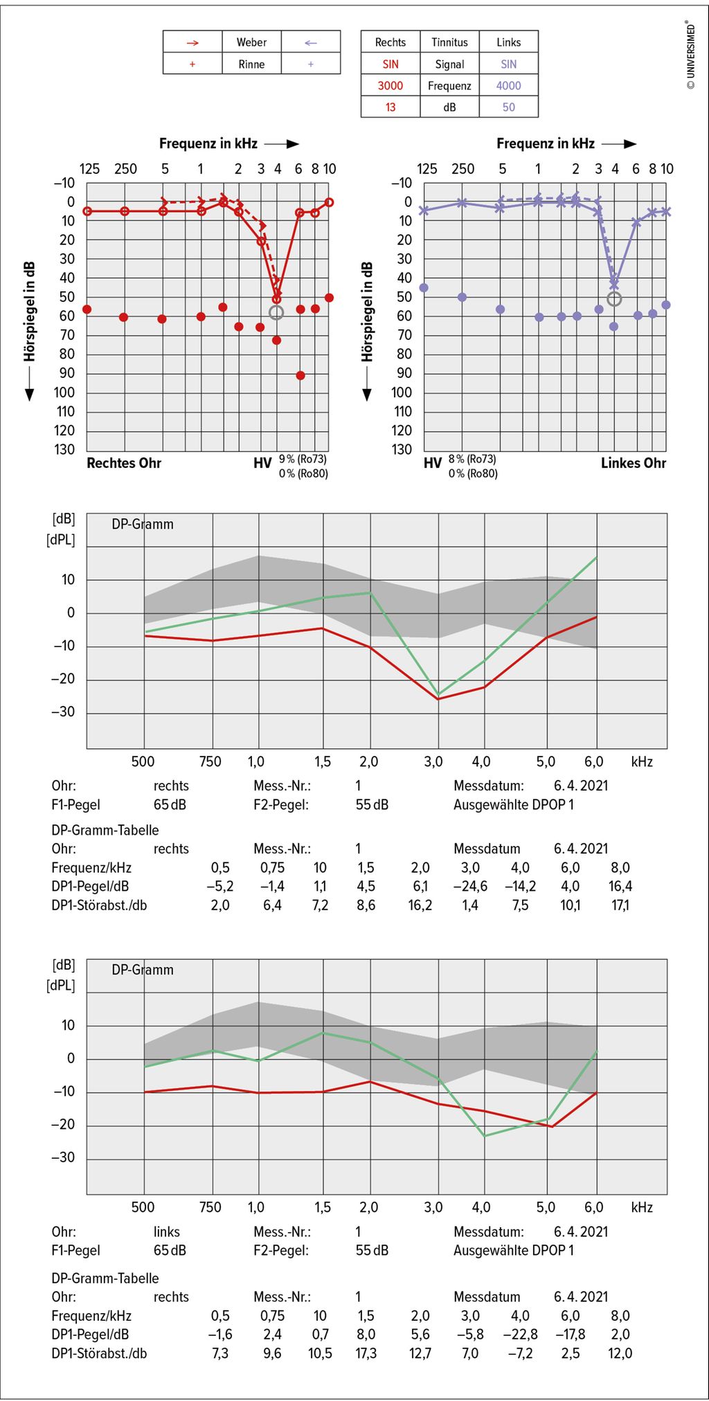 Differenzialdiagnose des zentralen und peripheren Tinnitus - HNO ...