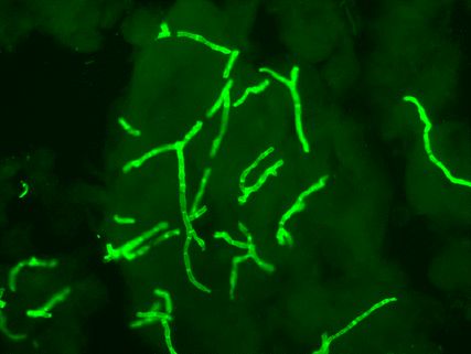 Filaments fongiques en microscopie en fluorescence